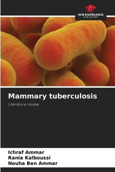Paperback Mammary tuberculosis Book