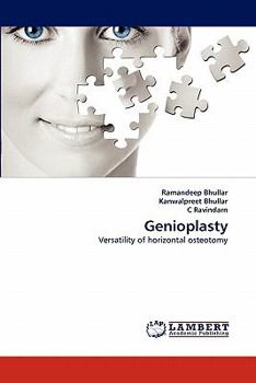 Paperback Genioplasty Book