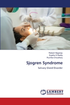 Paperback Sjogren Syndrome Book