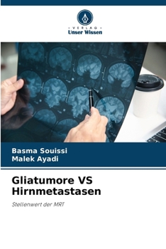 Paperback Gliatumore VS Hirnmetastasen [German] Book