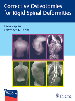 Hardcover Corrective Osteotomies for Rigid Spinal Deformities Book