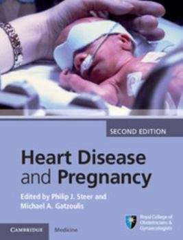 Hardcover Heart Disease and Pregnancy Book