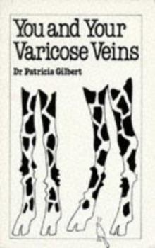 Paperback You and Your Varicose Veins (Overcoming Common Problems) Book