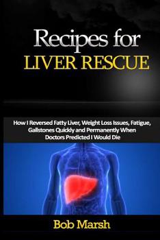 Paperback Recipes for Liver Rescue: How I Reversed Fatty Liver, Weight Loss Issues, Fatigue, Gallstones Quickly and Permanently When Doctors Predicted I W Book