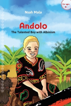 Paperback Andolo: The Talented Boy with Albinism Book
