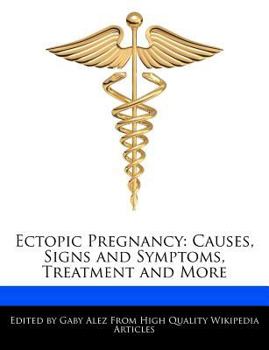 Paperback Ectopic Pregnancy: Causes, Signs and Symptoms, Treatment and More Book