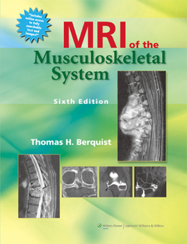 Hardcover MRI of the Musculoskeletal System with Access Code Book