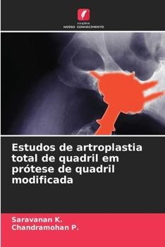 Estudos de artroplastia total de quadril em prótese de quadril modificada (Portuguese Edition)