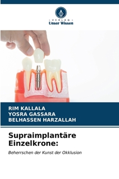 Paperback Supraimplantäre Einzelkrone [German] Book