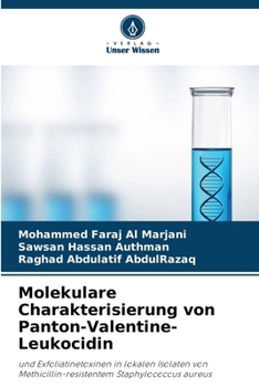 Paperback Molekulare Charakterisierung von Panton-Valentine-Leukocidin [German] Book
