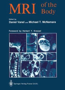 Paperback MRI of the Body Book