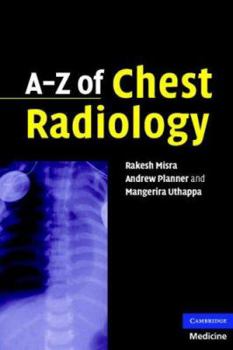 Paperback A-Z of Chest Radiology Book