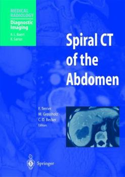 Paperback Spiral CT of the Abdomen Book