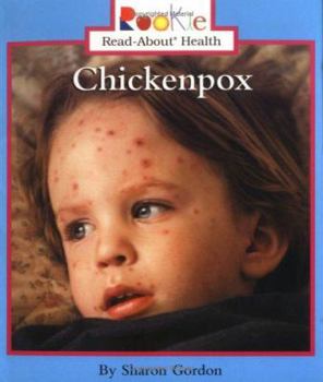 Chickenpox (Rookie Read-About Health) - Book  of the Scholastic Rookie Read-About: Health