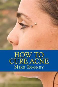 Paperback How To Cure Acne: What Is Acne And The Best Treatments For Acne Book