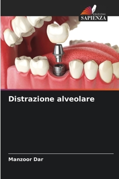 Paperback Distrazione alveolare [Italian] Book