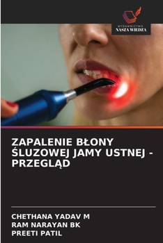 Zapalenie Blony Sluzowej Jamy Ustnej - PrzeglAd (Polish Edition)