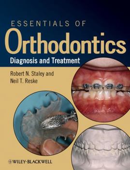 Paperback Essentials of Orthodontics: Diagnosis and Treatment Book