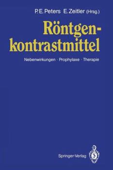 Paperback Röntgen Kontrastmittel: Nebenwirkungen - Prophylaxe - Therapie [German] Book