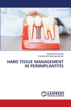 Paperback Hard Tissue Management in Periimplantitis Book