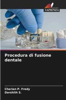 Procedura di fusione dentale (Italian Edition)