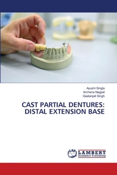 Cast Partial Dentures: Distal Extension Base