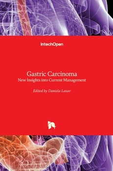 Hardcover Gastric Carcinoma: New Insights into Current Management Book