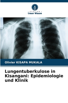 Paperback Lungentuberkulose in Kisangani: Epidemiologie und Klinik [German] Book