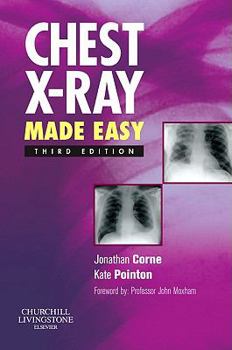 Paperback Chest X-Ray Made Easy Book