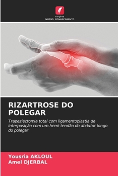 Rizartrose Do Polegar (Portuguese Edition)