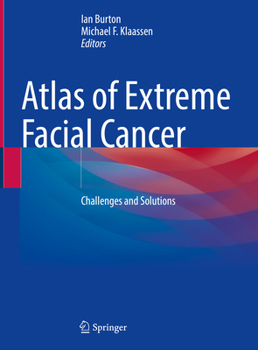 Hardcover Atlas of Extreme Facial Cancer: Challenges and Solutions Book