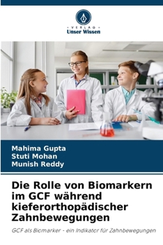 Paperback Die Rolle von Biomarkern im GCF während kieferorthopädischer Zahnbewegungen [German] Book