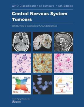 Paperback Central Nervous System Tumours: Who Classification of Tumours Book