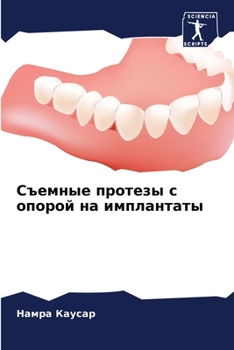 Paperback Съемные протезы с опорой [Russian] Book