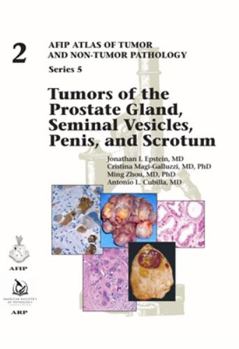 Hardcover Tumors of the Prostate Gland, Seminal Vesicles, , and Scrotum (AFIP Atlas of Tumor and Non-Tumor Pathology, Series 5) Book