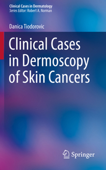 Paperback Clinical Cases in Dermoscopy of Skin Cancers Book