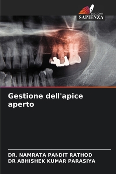 Paperback Gestione dell'apice aperto [Italian] Book