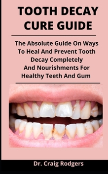 Paperback Tooth Decay Cure Guide: The Absolute Guide On Ways To Heal And Prevent Tooth Decay Completely And Nourishments For Healthy Teeth And Gum Book