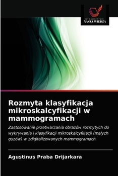 Paperback Rozmyta klasyfikacja mikroskalcyfikacji w mammogramach [Polish] Book