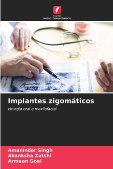 Paperback Implantes zigomáticos [Portuguese] Book