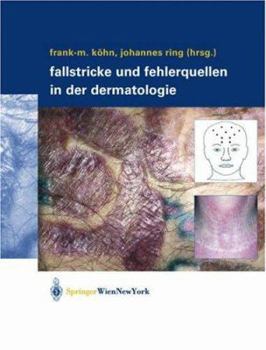 Hardcover Fallstricke und Fehlerquellen in der Dermatologie [German] Book