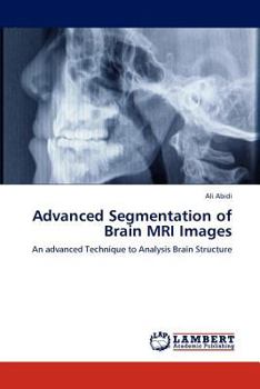 Paperback Advanced Segmentation of Brain MRI Images Book