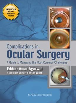 Hardcover Complications in Ocular Surgery: A Guide to Managing the Most Common Challenges Book