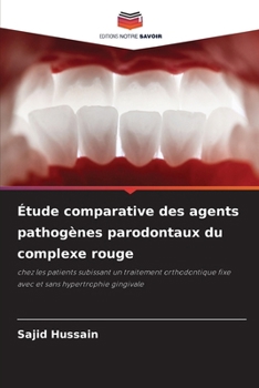 Paperback Étude comparative des agents pathogènes parodontaux du complexe rouge [French] Book