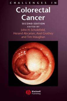 Hardcover Challenges in Colorectal Cancer Book