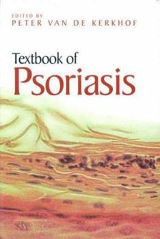 Hardcover Textbook of Psoriasis Book