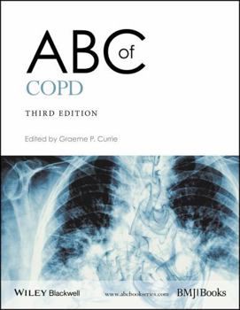 Paperback ABC of Copd Book