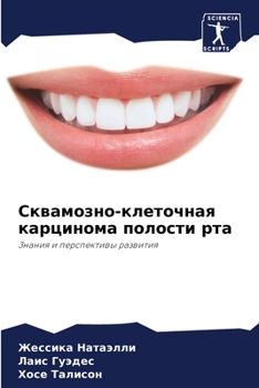 Paperback Сквамозно-клеточная кар& [Russian] Book