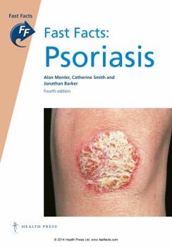 Paperback Fast Facts: Psoriasis Book