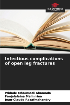 Paperback Infectious complications of open leg fractures Book